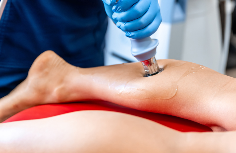 Stoßwellentherapie